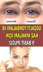 Gozalti Torbalari Ve Kaz Ayaklari Icin Ipuclari Goz Alti Morluklari V Faqen Time Brown Spots On Face Sun Spots On Skin Brown Spots On Skin