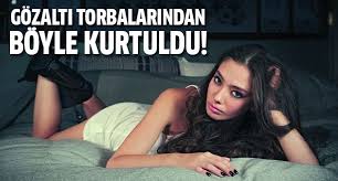 Neslihan Atagul Un Gozalti Torbalarindan Kurtuldu Son Tv