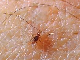 They love our professional service and we're proud to say joshua's pest control is locally owned and operated—a san diego original. Fleas On The Rebound Termite Pest Control