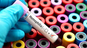How fast do you die from internal bleeding? World Haemophilia Day Here S Everything You Should Know About This Rare Disorder Health Hindustan Times