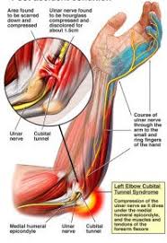 Pin On Cts Ulnar Neuropathy Exercises