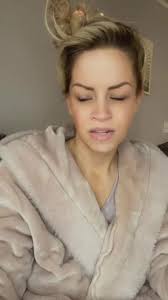 Tammy Lous Teeth Before