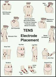 I Use A Tens Unit Myself For Ankylosing Spondylitis It Really Does Help Some This Chart Shows You The Fibromyalgia Tens Unit Therapy Tens Electrode Placement