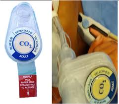 At alibaba.com for use in a hospital or medical clinic. Evaluation Of Real Time Tracheal Ultrasound Versus Colorimetric Capnography As A Point Of Care Tool For Confirmation Of Endotracheal Intubation A Randomized Controlled Study Springerlink