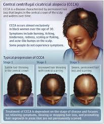 Causes are increased patches and dry, scaly skin surface. Facebook