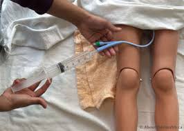 Image result for Bladder Irrigation