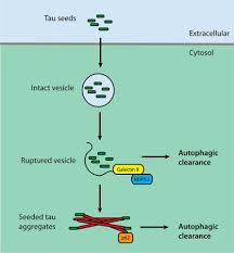 Hiện nay, gối kê cổ chữ u được sử dụng rộng rãi bởi sự tiện lợi của nó, dễ mang theo, êm ái tránh đau cổ. Galectin 8 Mediated Selective Autophagy Protects Against Seeded Tau Aggregation Journal Of Biological Chemistry
