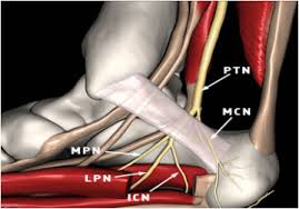 Image result for Calcaneus
