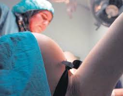 Somos conscientes de que el nacimiento de un hijo es un el equipo de parto natural es magnífico. Las Diez Complicaciones Mas Frecuentes Durante El Parto Nacion Farma Salud Y Medicina Para Todos