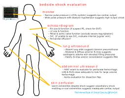 Approach To Shock Emcrit Project