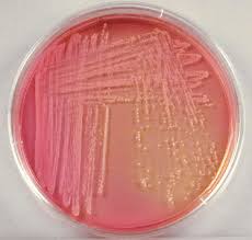 Image result for Staphylococcus Saprophyticus