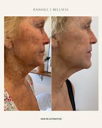 Nina Bui, RN (@ninabuirn) · San Diego, CA