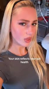 Anything I missed?? #accutane #accutanecheck #accutanejourney #accutan...