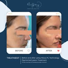 Montgomery Laser And Skin Spa