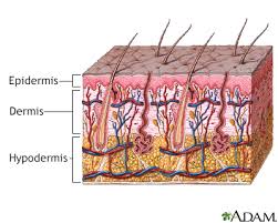 Cherry angiomas comprise of a large number of blood vessels. Cherry Angioma Information Mount Sinai New York