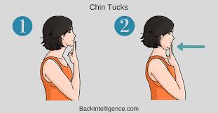 Simple Cervical Spinal Stenosis Exercises Plus Symptoms Causes Forward Head Posture Spinal Stenosis Exercises Cervical Spinal Stenosis