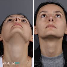 Marotta Plastic Surgery Specialists