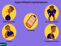 The early symptoms of lung cancer may be a slight cough or shortness of breath, depending on which part of the lung is affected. Hyperinflated Lungs Symptoms Causes Diagnosis And Treatment