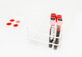 1 deciare that in the event i should be diagnosed with any conditions that does not require my removal from malaysia but requires medical treatment and i choose to remain in malaysia to. Medical Screening Package Ncsm