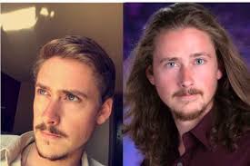 Fundraiser by Michael Mears : Children with Hair Loss