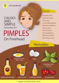Clusters of small red bumps. 10 Causes Of And Simple Remedies For Pimples On Forehead Pimples On Forehead Forehead Acne Forehead Acne Cause