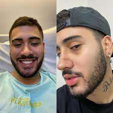 Cantores sertanejos antes da fama. Kevinho Mostra Antes E Depois Apos Passar Por Cirurgia No Nariz Nao Sabia O Que Era Respirar Redetv