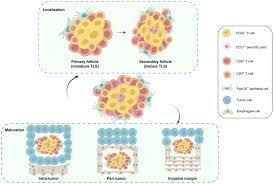 Image result for Primary Tumor Localization