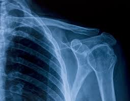 Image result for Shoulder Imaging