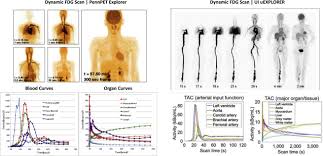 Check spelling or type a new query. Analysis Of Four Dimensional Data For Total Body Pet Imaging Pet Clinics