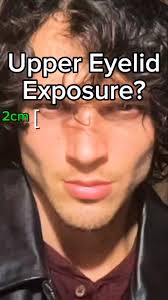 Join Joshua's Biohacking Community Today!