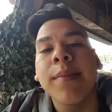 ICYMI: Antioxidants Speed Up Lung Cancer Swedish scientists have discovered  why two antioxidants accelerate tumor growth in mice, helping to explain  the results of disappointing human trials. bit.ly/1b8ZOoC