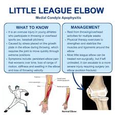 Image result for Growth Plate