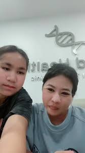 แอฟน่าลิง