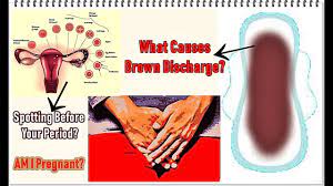 We did not find results for: Brown Discharge Before Period Causes Youtube
