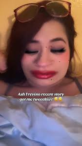Ash Trevino: A Humorous Therapy Moment
