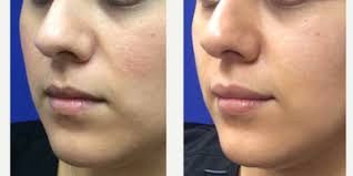 Karan K. Sra, MD, Board Certified Dermatologist