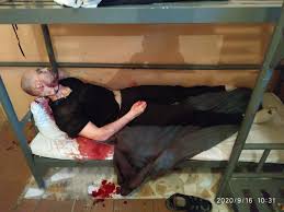 порезанные вены  голые девки, члены, голые девки с членами, дрочево, гуро,  извратское порно и прочая половая ёбля - смотреть бесплатно!