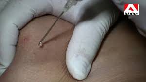 Injection 2 - video 3 - injection fantasy unfolds