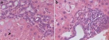 Image result for Mycotoxin