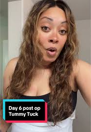 Aj Khalil Beverly Hills Tummy Tuck