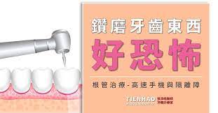 根管治療抽神經 那隻鑽牙齒的東西好恐怖 還會磨牙 還會噴滿口的水 好不舒服 endodontist dentistry decision making