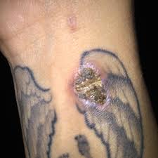 You can have tattoo ink made with the cremation ashes of your loved one. Faulty Elmers Glue Gun Ruins My Memorial Tattoo Lifts Ink And Ashes And This Is Their Response Album On Imgur