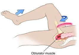 Image result for Obturator Sign