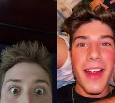 #duet with @benjaminbeckerrr #Inverted everytime he pops up i feel utter  jealousy for how perfect his teeth are 😂😂😂