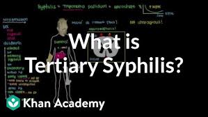 Image result for Tertiary Syphilis