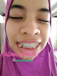 Selain baik untuk kesehatan karena kaya akan kalsium, susu juga adalah salah satu bahan alami yang bisa kamu pakai untuk memutihkan gigi. Fatimahnabila 2016