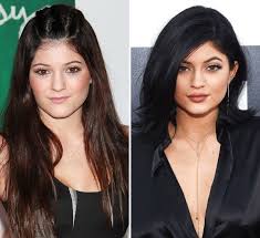 Has kylie jenner had plastic surgery?. The Curious Case Of Kylie Jenner Inside Jamari Fox Kylie Jenner Plastic Surgery Kardashian Plastic Surgery Plastic Surgery