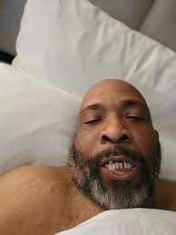 Bionic Smile Dental Implant Experience in Vegas