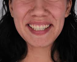 ＤＥＮＴＡＬ ＣＯＲＥ (@dentalcore1) · La Paz