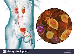 Penyakit ini bersifat kronis dan sistemik, yang menyerang nyaris semua organ dan jaringan tubuh. 10 Penyakit Organ Intim Akibat Pergaulan Bebas Berita Aneh Dan Unik Di Dunia